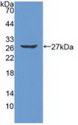Invitrogen Trypsin 2 Polyclonal Antibody, Invitrogen 100 &mu;L; Unconjugated:Antibodies,