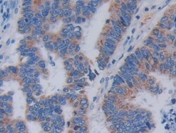 Invitrogen TOP3A Polyclonal Antibody, Invitrogen 20 &mu;L; Unconjugated:Antibodies,