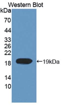 Invitrogen TOP3A Polyclonal Antibody, Invitrogen:Antibodies:Primary Antibodies