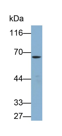 Invitrogen TESK1 Polyclonal Antibody, Invitrogen 20 &mu;L; Unconjugated:Antibodies,
