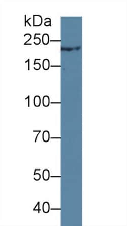 Invitrogen TCHH Polyclonal Antibody, Invitrogen 100 &mu;L; Unconjugated:Antibodies,