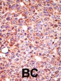 Invitrogen MGAT3 Polyclonal Antibody 400 &mu;L; Unconjugated:Antibodies,