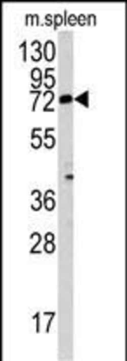 Invitrogen MGAT3 Polyclonal Antibody 400 &mu;L; Unconjugated:Antibodies,