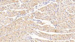 Invitrogen Tankyrase 2 Polyclonal Antibody, Invitrogen 100 &mu;L; Unconjugated:Antibodies,