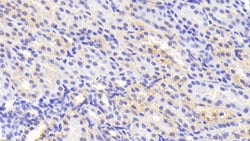 Invitrogen Tankyrase 2 Polyclonal Antibody, Invitrogen 100 &mu;L; Unconjugated:Antibodies,