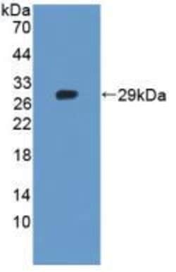 Invitrogen Tankyrase 2 Polyclonal Antibody, Invitrogen 100 &mu;L; Unconjugated:Antibodies,