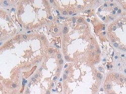 SRY Polyclonal Antibody, Invitrogen:Antibodies:Primary Antibodies