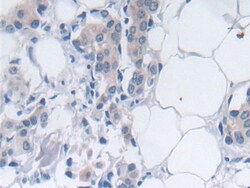 Invitrogen SRY Polyclonal Antibody, Invitrogen 20 &mu;L; Unconjugated:Antibodies,