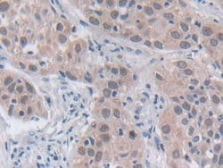 SRY Polyclonal Antibody, Invitrogen:Antibodies:Primary Antibodies