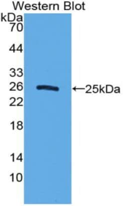 Invitrogen Sostdc1 Polyclonal Antibody, Invitrogen:Antibodies:Primary Antibodies