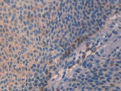 Invitrogen SLIT3 Polyclonal Antibody, Invitrogen 100 &mu;L; Unconjugated:Antibodies,