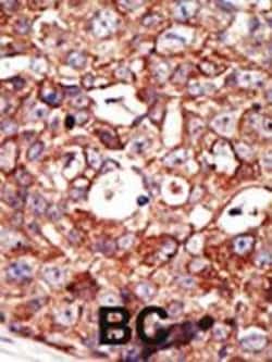Invitrogen ZMPSTE24 Polyclonal Antibody 400 &mu;L; Unconjugated:Antibodies,