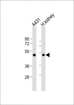 Invitrogen ZMPSTE24 Polyclonal Antibody 400 &mu;L; Unconjugated:Antibodies,