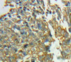 Invitrogen SIRP gamma Polyclonal Antibody, Invitrogen:Antibodies:Primary