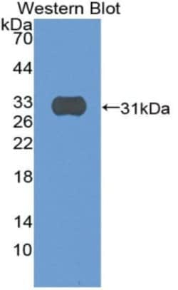 Invitrogen SIRP gamma Polyclonal Antibody, Invitrogen 100 &mu;L; Unconjugated:Antibodies,