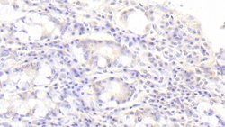 Invitrogen SGPL1 Polyclonal Antibody, Invitrogen 100 &mu;L; Unconjugated:Antibodies,