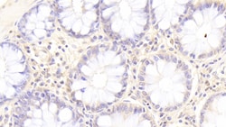 Invitrogen SGPL1 Polyclonal Antibody, Invitrogen 100 &mu;L; Unconjugated:Antibodies,