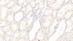 Invitrogen SGPL1 Polyclonal Antibody, Invitrogen 100 &mu;L; Unconjugated:Antibodies,