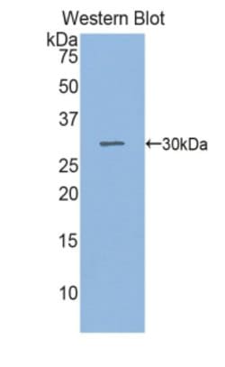 Invitrogen SGPL1 Polyclonal Antibody, Invitrogen 100 &mu;L; Unconjugated:Antibodies,