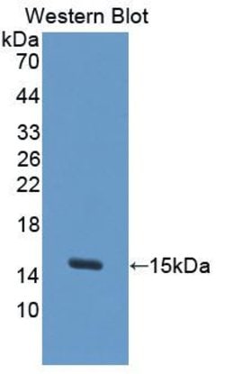 Invitrogen S100A7A Polyclonal Antibody, Invitrogen:Antibodies:Primary Antibodies