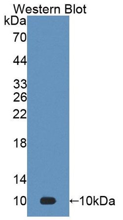 S100A7 Polyclonal Antibody, Invitrogen:Antibodies:Primary Antibodies