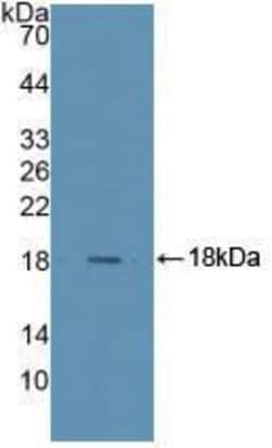 RNASE4 Polyclonal Antibody, Invitrogen:Antibodies:Primary Antibodies