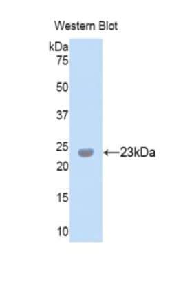 Invitrogen PXDN Polyclonal Antibody, Invitrogen 20 &mu;L; Unconjugated:Antibodies,