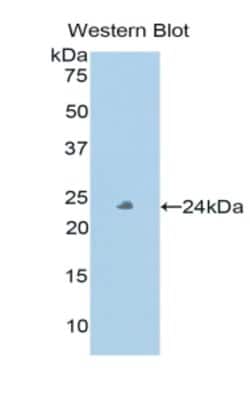 PXDN Polyclonal Antibody, Invitrogen:Antibodies:Primary Antibodies