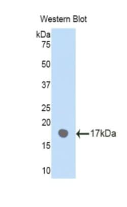 Invitrogen PLXNB1 Polyclonal Antibody, Invitrogen 100 &mu;L | Buy Online | Invitrogen&trade; | Fisher Scientific