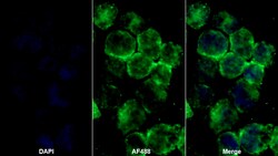 Invitrogen PLOD1 Polyclonal Antibody, Invitrogen 100 &mu;L; Unconjugated:Antibodies,