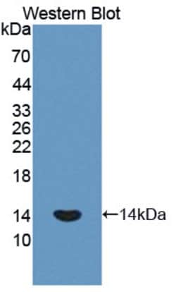 Invitrogen PLOD1 Polyclonal Antibody, Invitrogen 100 &mu;L; Unconjugated:Antibodies,