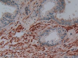 Invitrogen PLAA Polyclonal Antibody, Invitrogen 100 &mu;L; Unconjugated:Antibodies,