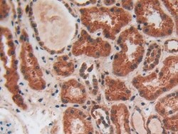 Invitrogen PLAA Polyclonal Antibody, Invitrogen 100 &mu;L; Unconjugated:Antibodies,