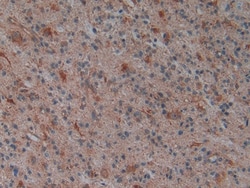 Invitrogen PLAA Polyclonal Antibody, Invitrogen 100 &mu;L; Unconjugated:Antibodies,