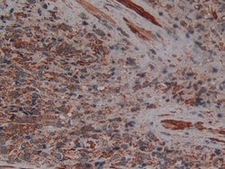 Invitrogen PLAA Polyclonal Antibody, Invitrogen 100 &mu;L; Unconjugated:Antibodies,