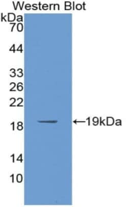 PABPC1L Polyclonal Antibody, Invitrogen:Antibodies:Primary Antibodies