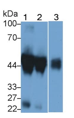 Invitrogen ORM1 Polyclonal Antibody, Invitrogen 100 &mu;L; Unconjugated:Antibodies,