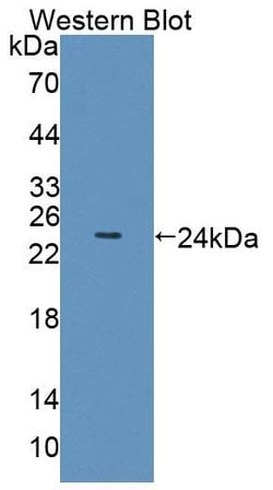 Invitrogen OLFM3 Polyclonal Antibody, Invitrogen 100 &mu;L; Unconjugated:Antibodies,