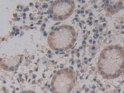 Invitrogen MPEG1 Polyclonal Antibody, Invitrogen 20 &mu;L; Unconjugated:Antibodies,