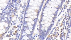 MT1 Polyclonal Antibody, Invitrogen:Antibodies:Primary Antibodies