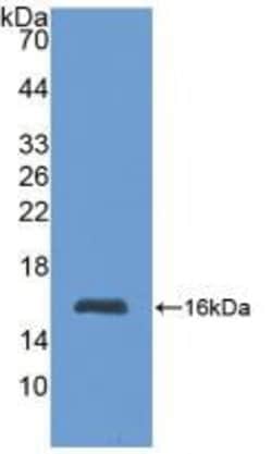 MT1 Polyclonal Antibody, Invitrogen:Antibodies:Primary Antibodies