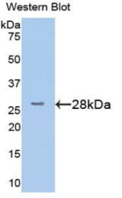 STING Polyclonal Antibody, Invitrogen:Antibodies:Primary Antibodies