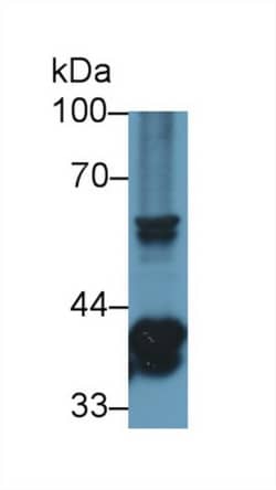 Invitrogen STING Polyclonal Antibody, Invitrogen 100 &mu;L; Unconjugated:Antibodies,