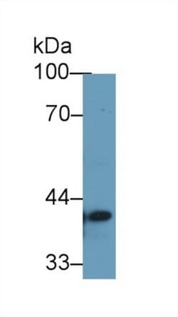 STING Polyclonal Antibody, Invitrogen:Antibodies:Primary Antibodies