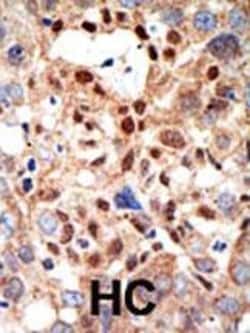 Invitrogen PML Polyclonal Antibody 400 &mu;L; Unconjugated:Anticuerpos