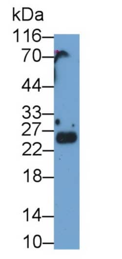 Invitrogen SHISA4 Polyclonal Antibody, Invitrogen 100 &mu;L | Buy Online | Invitrogen&trade; | Fisher Scientific