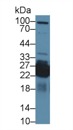 Invitrogen SHISA4 Polyclonal Antibody, Invitrogen 100 &mu;L | Buy Online | Invitrogen&trade; | Fisher Scientific