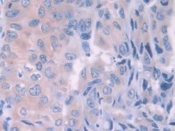 HFE2 Polyclonal Antibody, Invitrogen:Antibodies:Primary Antibodies