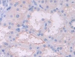 HFE2 Polyclonal Antibody, Invitrogen:Antibodies:Primary Antibodies