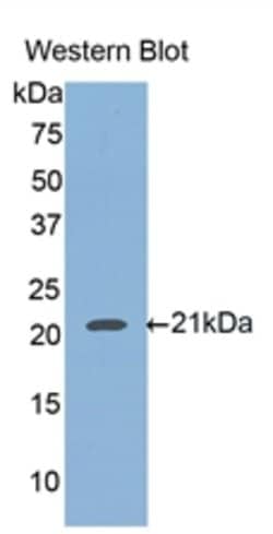 HFE2 Polyclonal Antibody, Invitrogen:Antibodies:Primary Antibodies